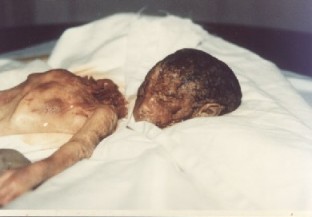 Inilah yang Terjadi Pada Bayi yang di-Aborsi (Hentikan Aborsi!)(DP inside!!) 9