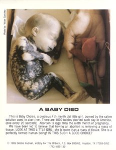 Inilah yang Terjadi Pada Bayi yang di-Aborsi (Hentikan Aborsi!)(DP inside!!) 10